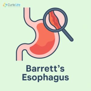 Barretts_Esophagus_at_Curis_Life_in_Andheri_West