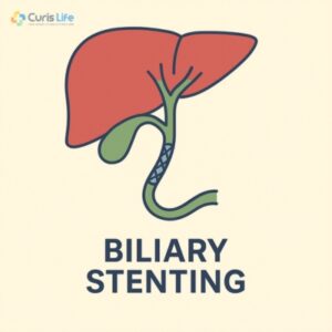 Biliary_Stenting_at_Curis_Life_in_Andheri_West