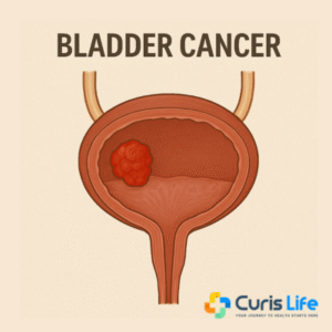 Bladder_Cancer_Treatment_Curis_Life_Andheri_West