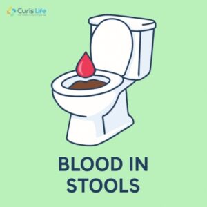 Blood_in_Stools_in_Andheri_West_at_Curis_Life