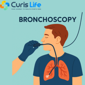 Bronchoscopy_Procedure_in_Andheri_West_at_Curis_Life
