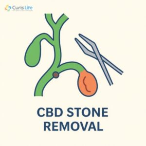 CBD_Stone_Removal_in_Andheri_West_at_Curis_Life