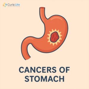 Cancers_of_stomach_in_Andheri_West_at_Curis_Life - Copy