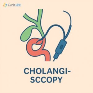 Cholangioscopy_in_Andheri_West_at_Curis_Life