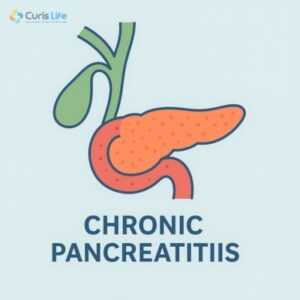 Chronic_pancreatitis_in_Andheri_West_at_Curis_Life