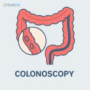 Colonoscopy_in_Andheri_West_at_Curis_Life