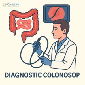 Diagnostic_Colonoscopy_in_Andheri_West_at_Curis_Life