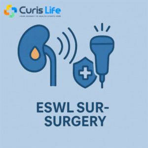 ESWL_Surgery_Andheri_West_Curis_Life