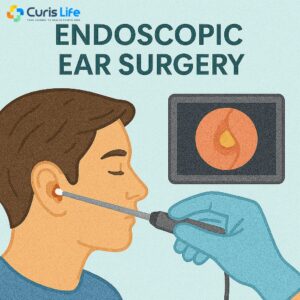 Endoscopic_Ear_Surgery_Ent_in_Andheri_West_at_Curis_Life
