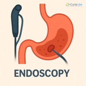 Endoscopy_in_Andheri_West_at_Curis_Life