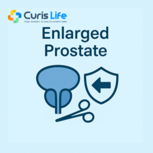 Enlarged_Prostate_Treatment_Andheri_West_Curis_Life