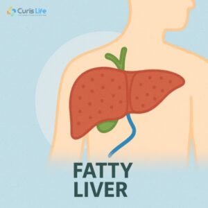 Fatty_Liver_in_Andheri_West_at_Curis_Life