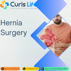 Hernia_Curis_life_Andheri_West.png