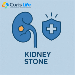 Kidney_Stones_Treatment_Andheri_West_Curis_Life