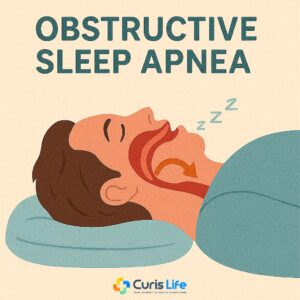 Obstructive_Sleep_Apnea_Treatment_in_Andheri_West_at_Curis_Life