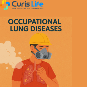 Occupational_Lung_Diseases_Treatment_in_Andheri_West_at_Curis_Lif