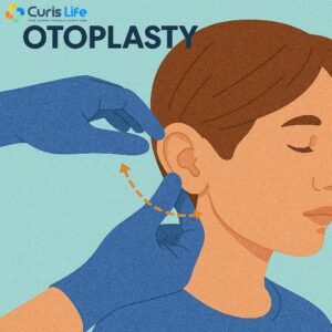 Otoplasty_Ent_in_Andheri_West_at_Curis_Life