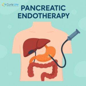 Pancreatic_Endotherapy_in_Andheri_West_Curis_Life