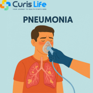 Pneumonia_Treatment_in_Andheri_West_at_Curis_LifePneumonia_Treatment_in_Andheri_West_at_Curis_Life
