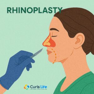 Rhinoplasty_Ent_in_Andheri_West_at_Curis_Life