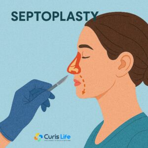 Septoplasty_Ent_in_Andheri_West_at_Curis_Life