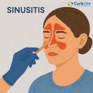 Sinusitis_Ent_in_Andheri_West_at_Curis_Life