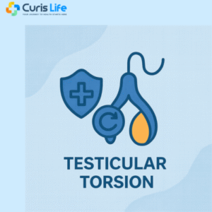 Testicular_Torsion_Treatment_Andheri_West_Curis_Life