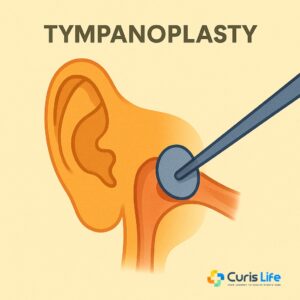 Tympanoplasty_Ent_in_Andheri_West_at_Curis_Life