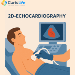 2D_Echocardiography_Test_in_Andheri_West_at_Curis_Life