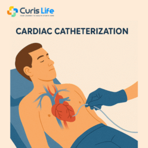 Cardiac_Catheterization_Procedure_in_Andheri_West_at_Curis_Life