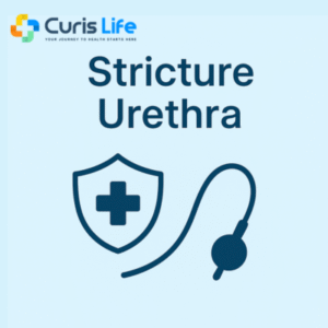 Stricture_Urethra_Andheri_West_Curis_Life