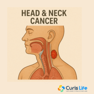 Head_and_Neck_Cancer_Treatment_Curis_Life_Andheri_West