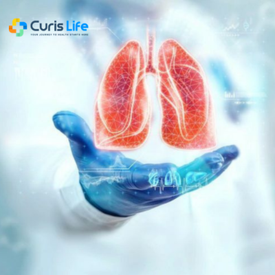 pulmonologist-doctor-andheri-west-curis-life-clinic