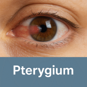pterygium_surgery_curis_life_andheri_west.png