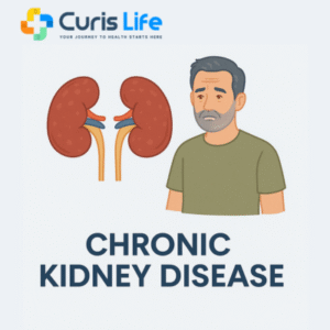 Chronic_Kidney_Disease_Treatment_Curis_Life_Andheri_West