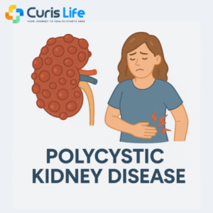 Polycystic_Kidney_Disease_Treatment_Curis_Life_Andheri_West