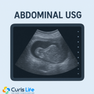 abdominal_usg_Curis_Life_Andheri_West