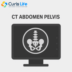 ct_abdomen_Curis_Life_Andheri_West