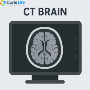 ct_brain_Curis_Life_Andheri_West
