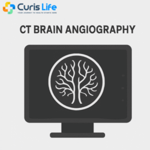 ct_brain_angiography_Curis_Life_Andheri_West