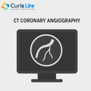 ct_coronary_angiography_Curis_Life_Andheri_West