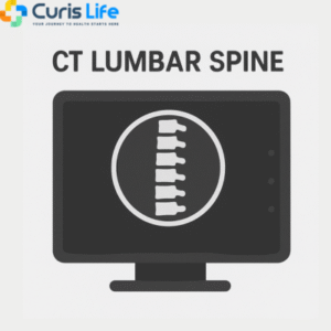 ct_lumbar_spine_Curis_Life_Andheri_West