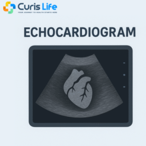 echocardiogram_Curis_Life_Andheri_West