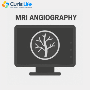 mr_angiography_Curis_Life_Andheri_West