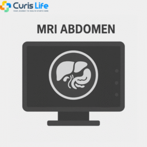mri_abdomen_Curis_Life_Andheri_West