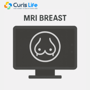 mri_breast_Curis_Life_Andheri_West