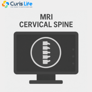 mri cervical spine Curis Life Andheri West