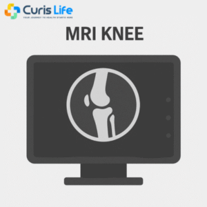 mri_knee_Curis_Life_Andheri_West