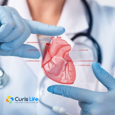 cardiologist-doctor-andheri-west-curis-life-clinic